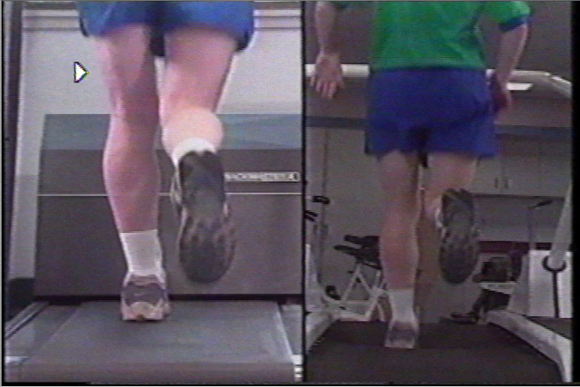 Treadmills