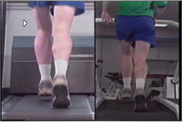Home Exercise Equipment